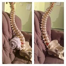 Ohh What A Great Visual For Showing What Is Happening With The Spine In Most Couch Seated Situations Spine Health Physical Therapy Massage Therapy