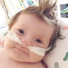 Oliver's TARP Syndrome Journey (@OliversTARPsyndromejourney) • Facebook