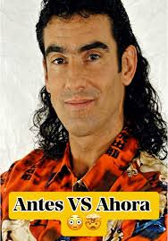 Miguel Varoni's Facelift: Reaction and Buzz