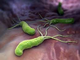 Gastritis Was Tun Bei Magenschleimhautentzundung Gesund Co At