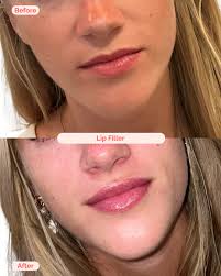 Julia Lazarus, RN, BSN