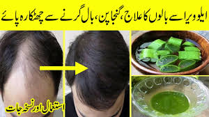 Wash off with cold water. Aloe Vera Hair Growth Oil For Thick Hair Ø¨Ø§Ù„ Ú¯Ø±Ù†Ø§ Ø¨Ù†Ø¯ Ú¯Ø§Ø±Ù†Ù¹ÛŒ Ú©Û'Ø³Ø§ØªÚ¾ Video Dailymotion