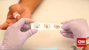 Check spelling or type a new query. Hubungan 4 Tipe Golongan Darah Dengan Risiko Penyakit