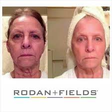 Rodan + Fields Dermatologists ~ Las Vegas, NV