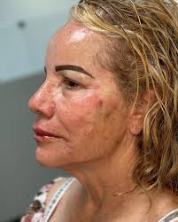 Dra. Berenice Caro del...