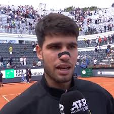 Carlos Alcaraz is looking better and better! 🤩