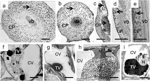 Why do plant cells possess large sized vacuoles. Co Occurrence Of Tannin And Tannin Less Vacuoles In Sensitive Plants Springerlink