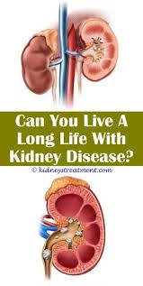 Pin On What Is Kidney Disease