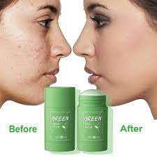 Green Tea Eggplant Purifying Clay Stick Mask In 2021 Facial Masks Skin Types Acne Treatment Mask