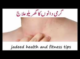 She is a famous personality best known for her tips, totkas, weight loss totkay … disclaimer: Wn Garmi Dano Ka Ilaj Chehre Face Ke Dano Ka Herbal Desi Totkay Health And Fitness Tips