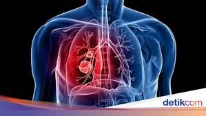 Bernapas adalah proses fisik yang terdiri dari inhalasi, ekshalasi. 6 Organ Pernapasan Manusia Lengkap Beserta Fungsinya