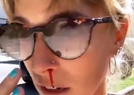 Dani la chepi se encontraba caminando mientras realizaba una filmación para sus redes sociales. Dani La Chepi Termino Ensangrentada En Un Intento De Robo Se Acabaron Las Historias En La Calle