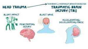 Blunt Trauma What Is It Diagnosis Outcomes And More Osmosis