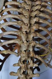 Back, bones and human spin diseases explanation vector. Hd Wallpaper Photo Of Human S Spinal Column Bones Skeleton Back Spine Wallpaper Flare