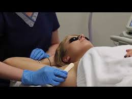 540.658.1100 click here for driving directions. Laser Hair Removal Near Me In Glen Allen Va Rejuvenate Md