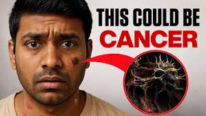 song of india plant की पीली,झड़ती पत्तियों का समाधान/yellow brown leaves  and leaf falling problem