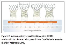 Cardiac Interventions Today Corevalve Assessing The