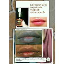 Maybe you would like to learn more about one of these? Discount Toko Baru Cara Memerahkan Bibir Secara Alami Dalam 1 Hari Sunpro Propolis Nasa Shopee Indonesia