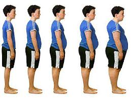 Resultado de imagen de imagenes de la obesidad