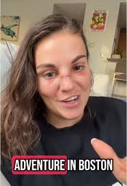 Don’t freak out I know my face is busted… it’s from my first episode of my  new series: MINI ADVENTURES IN BOSTON #tryingnewthings #fun #new #series  #storytime #boston #ouch #funnystories #clumsygirl ...