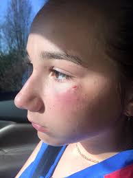 Lost White Face Mask at Spencer County Fastpitch Softball Clinic