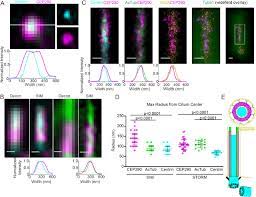 This data was prepared from histological sections made on human eyes. Superresolution Microscopy Reveals Photoreceptor Specific Subciliary Location And Function Of Cep290 Biorxiv