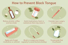 Image result for brown tongue symptoms