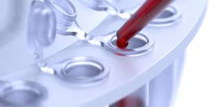 After initial exposure and possible primary infection,. Hiv Testing Basics Poz
