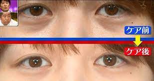 林先生が驚く初耳学 目のクマ改善 青クマ 茶クマ 黒クマの原因と対処方法 ムンクの顔体操のやり方 綺麗になりたいnavi 目のクマ 綺麗になりたい 顔