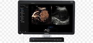 Tỷ lệ kết quả bóng đá được cải thiện liên tục bởi đội ngũ chuyên nghiệp. Kontrastmittel Sonographie Ultraschall Radiographie Medizinische Bildgebung Hinh Bong Hoa Dao Png Herunterladen 1240 563 Kostenlos Transparent Bildschirm Png Herunterladen