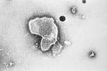 Koorts, een piepende, snelle ademhaling, intrekkingen tussen de ribben en niet goed drinken. Respiratory Syncytial Virus Wikipedia