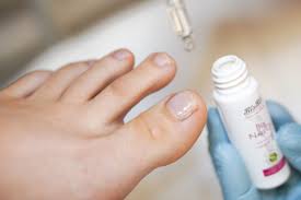 Image result for mykoza nehtů