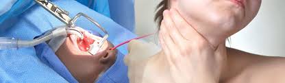 Evidently, chronic throat infection is one of the most common reasons adults have their tonsils removed. Tonsil Surgery In India Tonsil Removal Cost Tonsillectomy