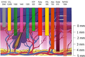 Hair Removal Lasers Explained Dr Nathan Holt