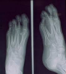 Pin On Life As A Radiographer