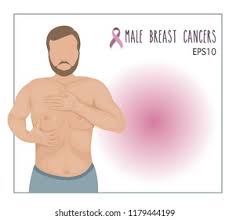 The treatment options for male breast cancer are similar to those for female breast cancer. Vector Man Breast Cancer Checking Himselfawareness Stock Vector Royalty Free 1179444199