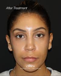 ✨ Can you guess the treatment stack? Some of the most beautiful  transformations are the ones you feel before you even notice the details —  the kind that make you look rested,