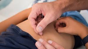 Gel antidouleur +++efficace et qui soigne la douleur naturellement et favorise par sa silice l'elasticité de. Quand Et Pourquoi Avoir Recours A L Acupuncture Pour Le Bebe Et L Enfant Magicmaman Com