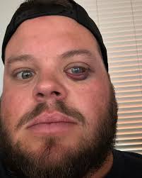 Zach Wayne (@zcoovert) • Instagram photos and videos