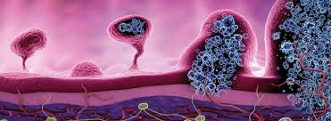 Blut im stuhl ist in gewisser hinsicht eine ausnahme, denn schon im frühstadium kann okkultes blut oftmals. Infografik So Entsteht Darmkrebs Ksb Bauchzentrum