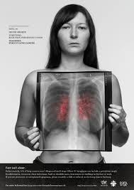 Lung cancer may spread (metastasize) to the brain. Rankin Shoots Campaign To Raise Awareness Of Lung Cancer In People Who Ve Never Smoked Lbbonline