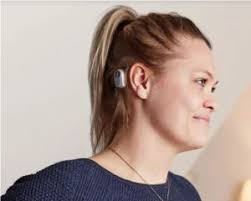 single sided deafness