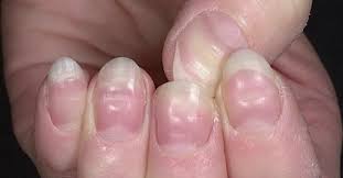 Check spelling or type a new query. Studying Your Nails Could Reveal Important Warnings Your Body Is Sending You Littlethings Com