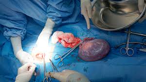 Hi doc, saya telah menjalani pembedahan selepas rahang selama 2 bulan, semalam saya membuka pendawaian (wayar) tetapi mulut saya tidak dapat dibuka dengan lebar seperti dahulu, berapa. Pembedahan Dr R Juhaidah Blog