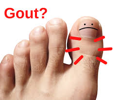 Image result for gout symptoms toe