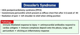 Image result for Post-MI Pericarditis