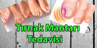Tirnak Mantari Panosundaki Pin