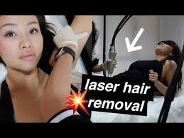 what a full body laser hair removal is