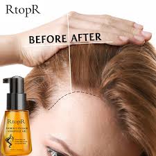 Moroccan oil around rs 3000 but i can use it for a solid 2 years. Rtopr Moroccan Prevent Hair Loss Product Hair Growth Essential Oil Easy To Carry Hair Care Nursing 35ml Both Male And Female Can Use Lazada