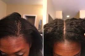 You may also want to add a moisturizer of your choice. If Your Natural Hair Is Too Damn Dry Stop What You Re Doing And Read These 12 Expert Tips